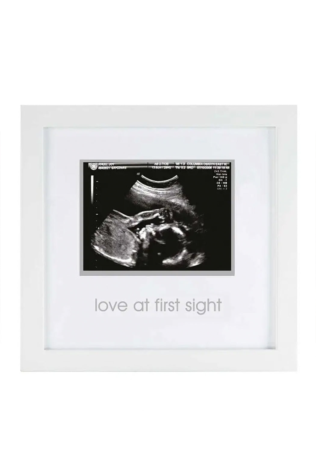 Pearhead Love At First Sight Sonogram Frame